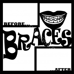 Braces